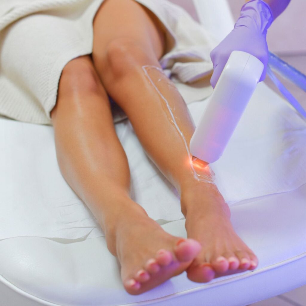 Laser Hair Removal
