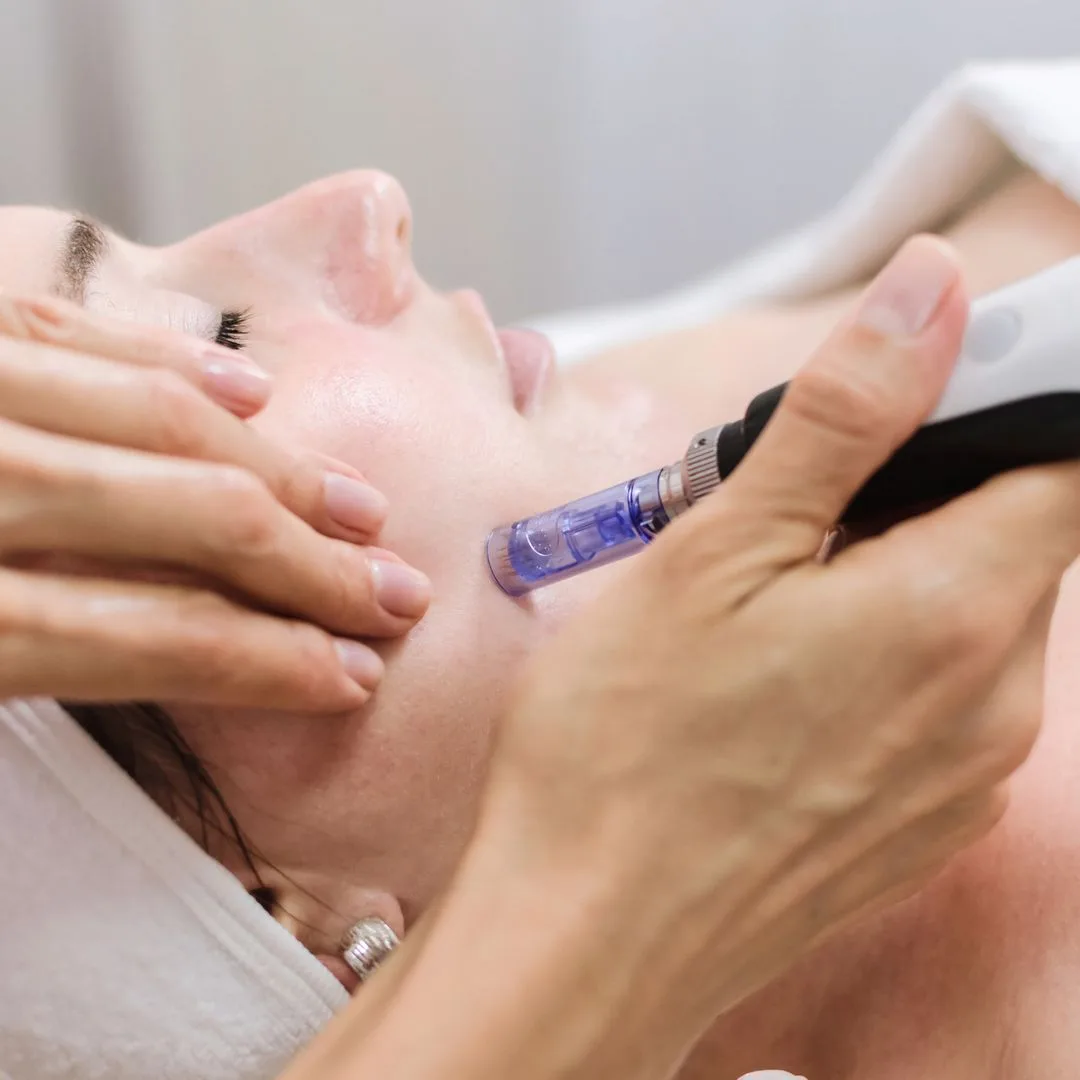 A woman is relaxing in a spa setting, her eyes peacefully closed as she receives a facial treatment. The device, emitting soothing blue light, is deftly maneuvered by expert hands. Wrapped in a towel, she enjoys the benefits perhaps akin to cutting-edge radiofrequency microneedling.