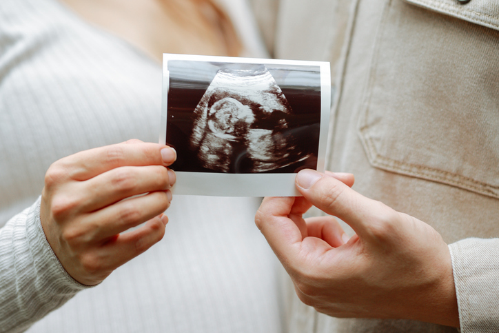 Couple holding an ultrasound photo, celebrating pregnancy after IVF treatment at Anova Fertility in Toronto